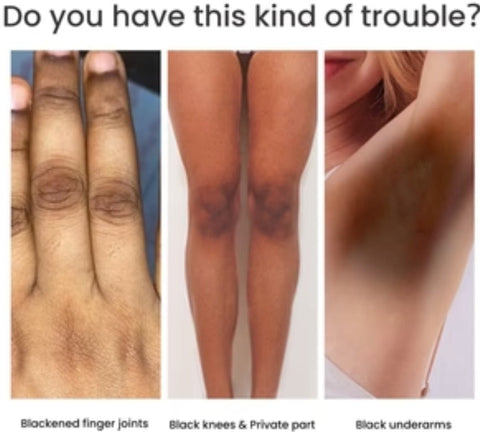 Women's Skin Pigmentation Care